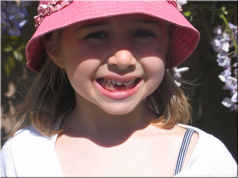 manque deux dents.jpg