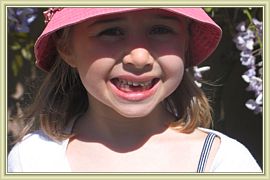 manque deux dents